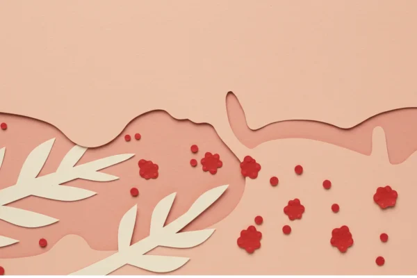 Chest Waxing Breakouts: 72% Are Folliculitis in 2026